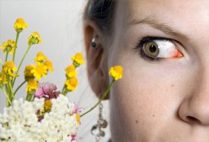 Augen Allergie Symptome